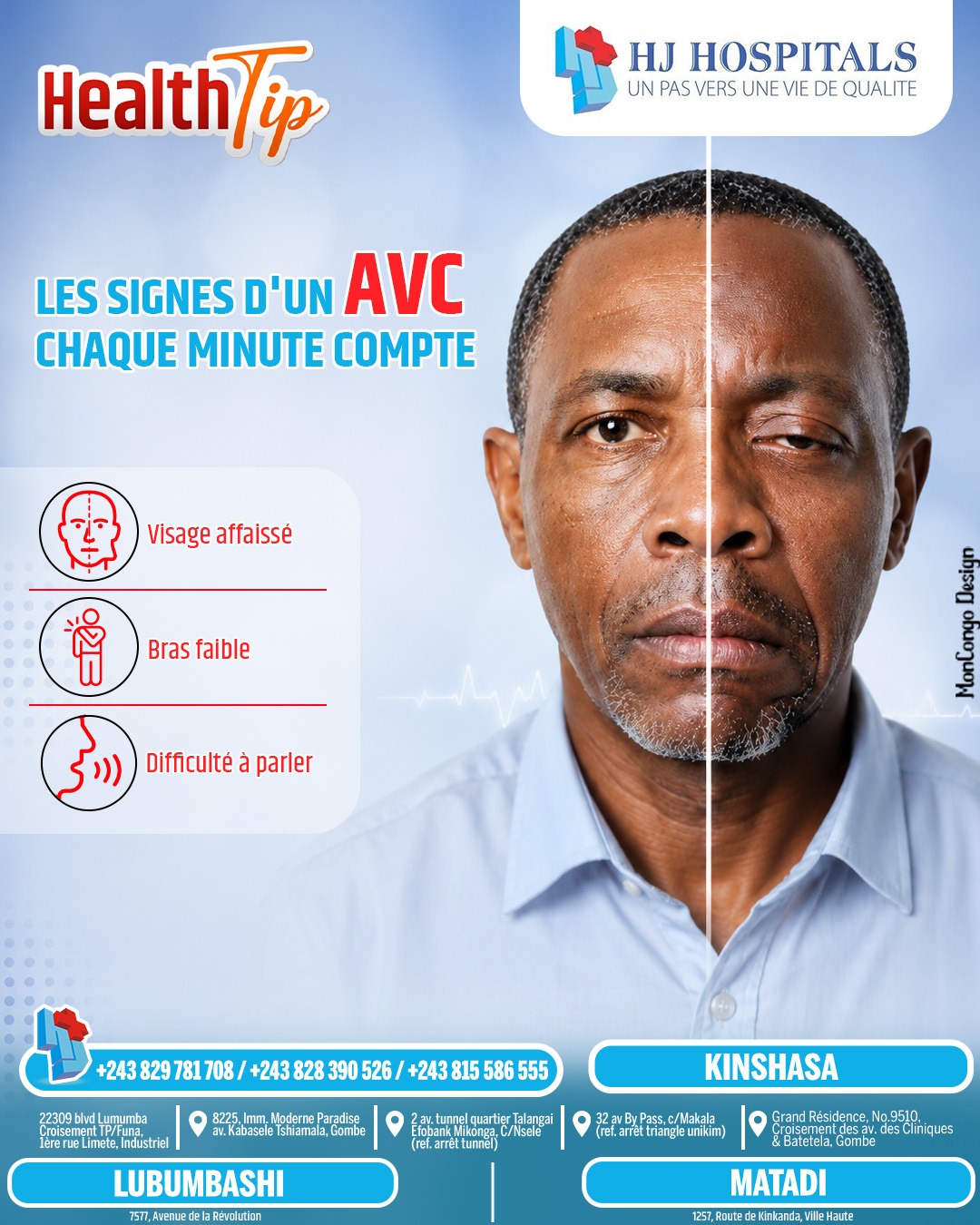 Les signes d'un AVC