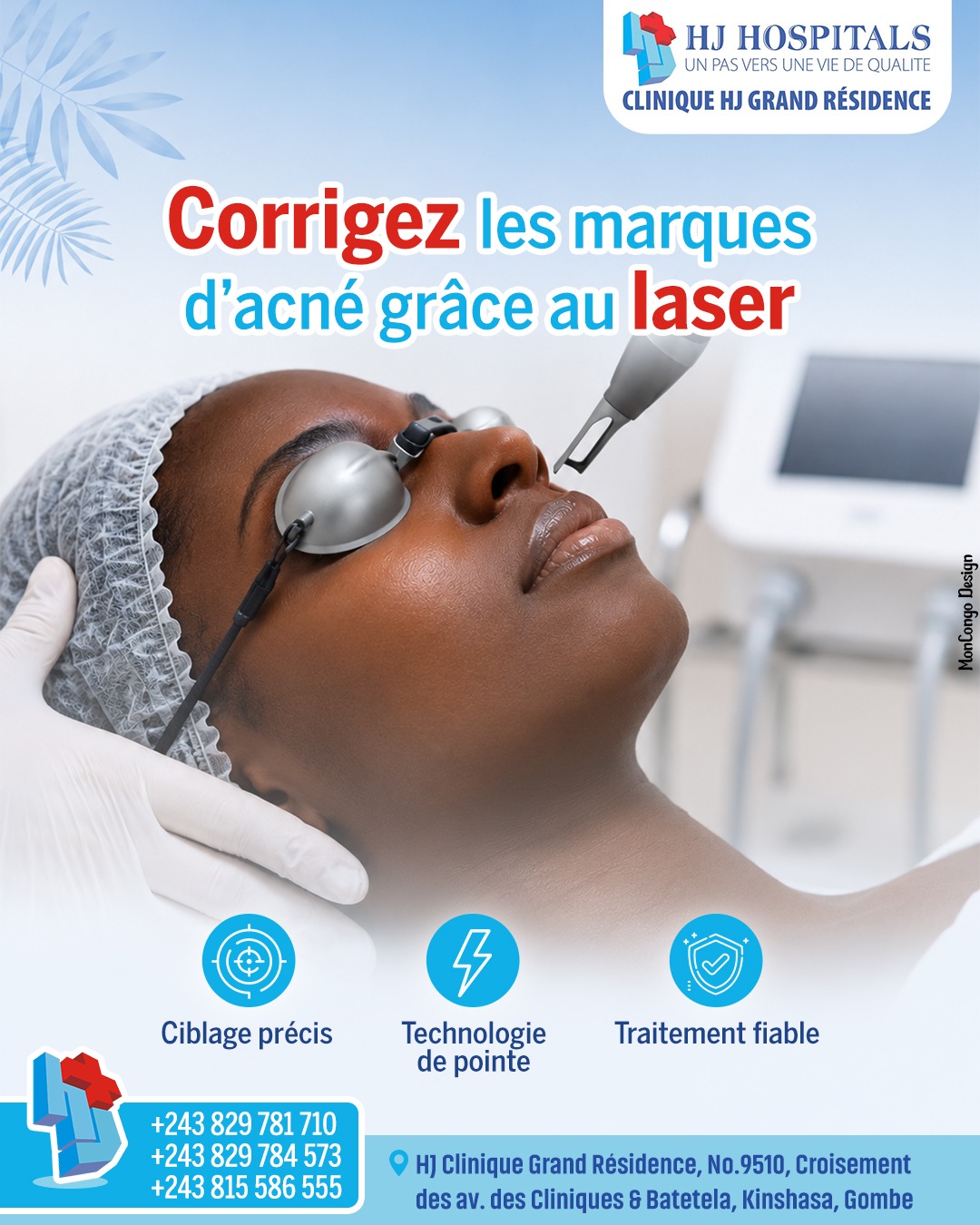 Corrigez les marques d’acné grâce au laser