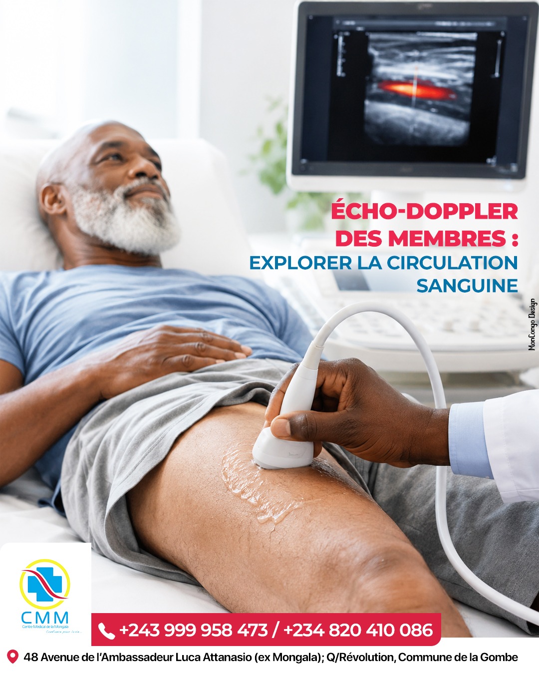 Écho-Doppler des membres : explorer la circulation sanguine