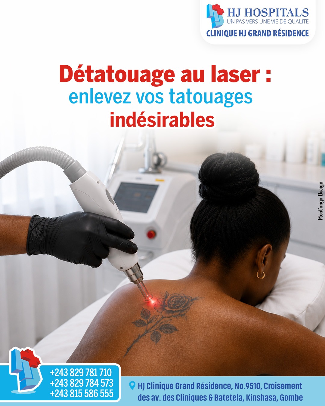 Détatouage au laser : enlevez vos tatouages indésirables