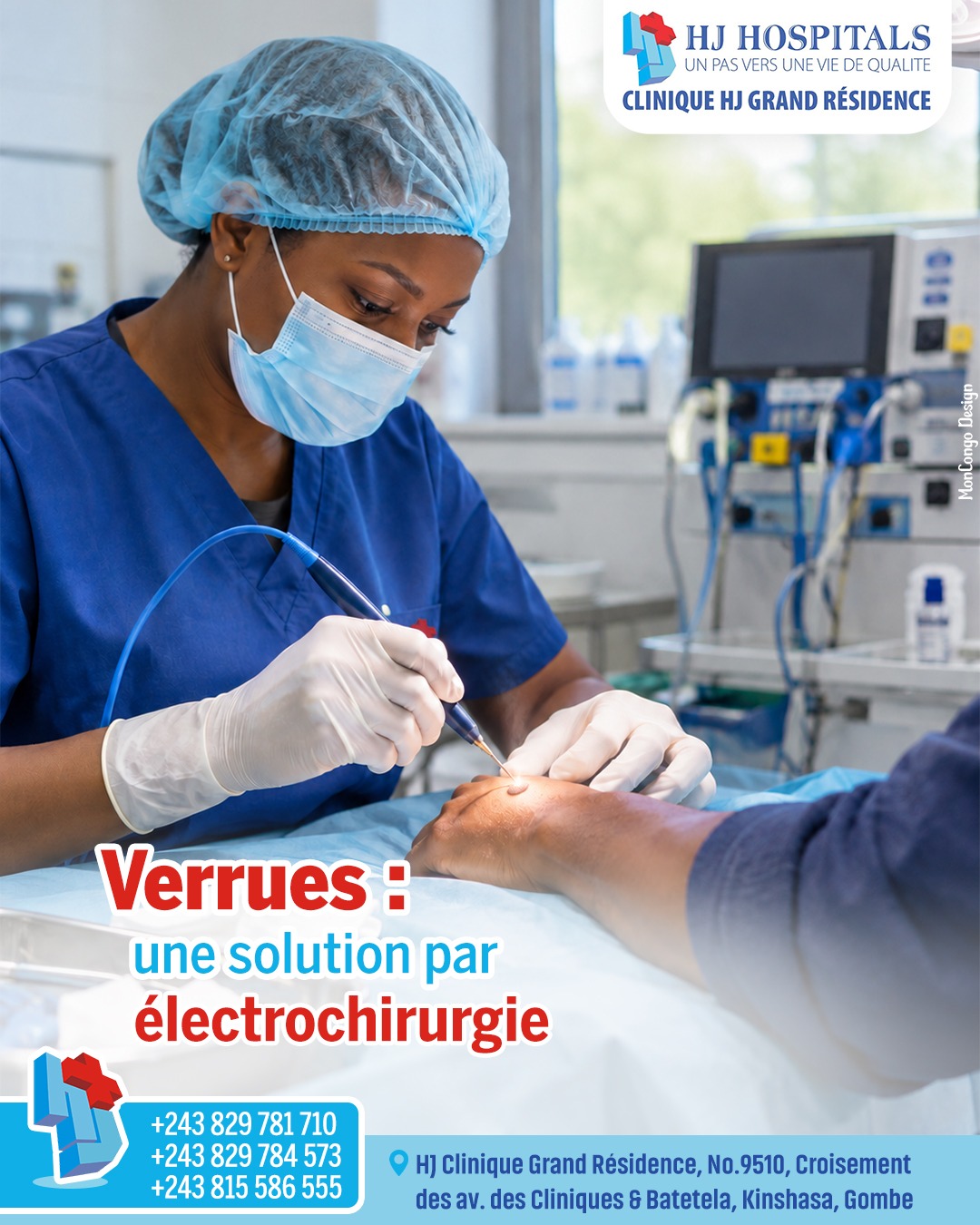 Électrochirurgie : une option pour traiter les verrues